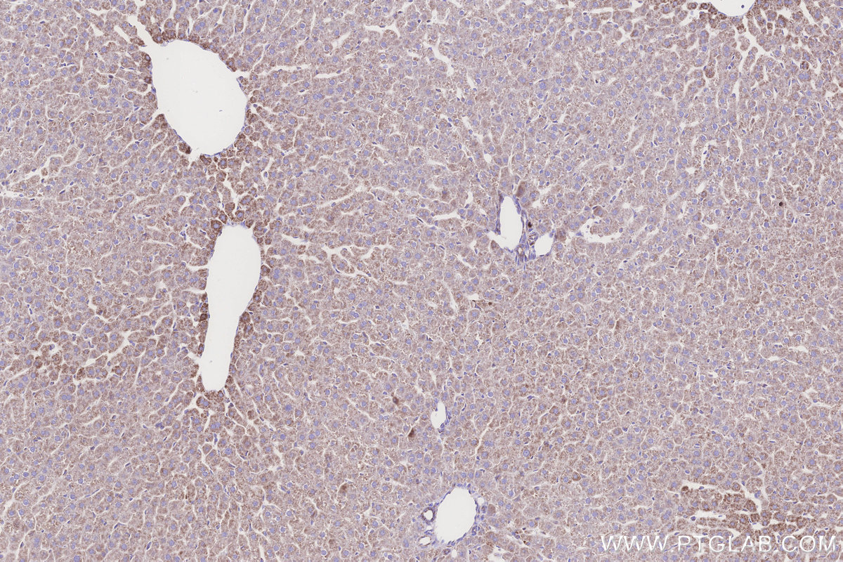 Immunohistochemical analysis of paraffin-embedded rat liver tissue slide using KHC3242 (NDUFS1 IHC Kit).