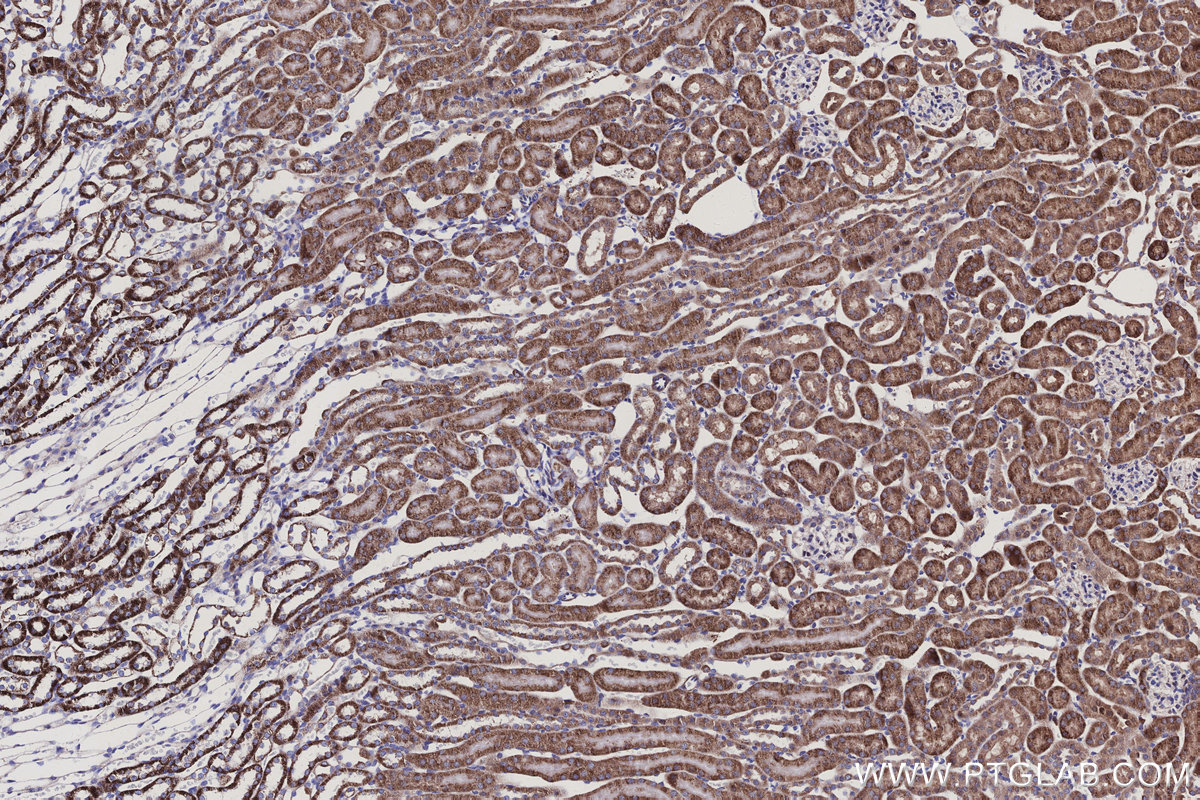 Immunohistochemical analysis of paraffin-embedded mouse kidney tissue slide using KHC3149 (NDUFS2 IHC Kit).