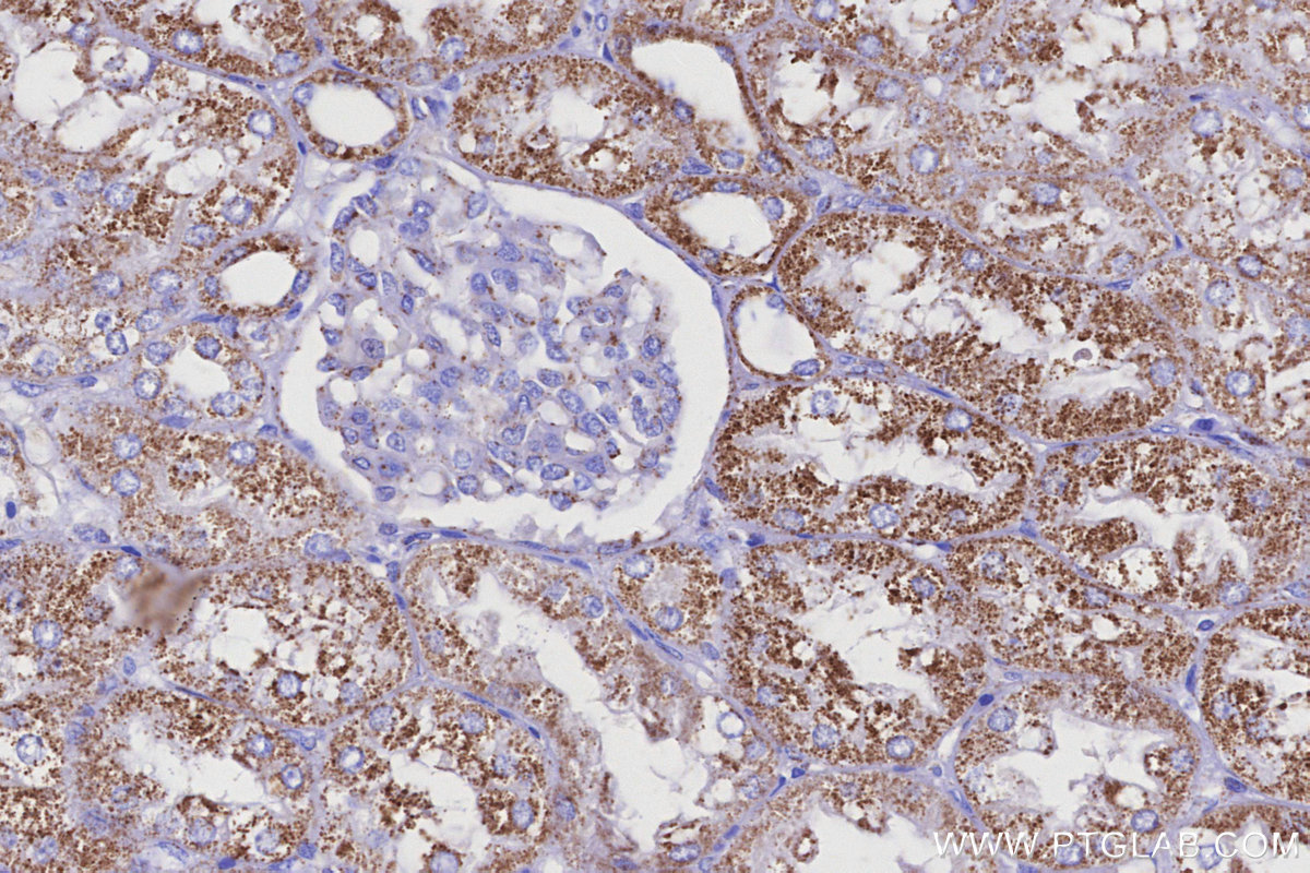 Immunohistochemical analysis of paraffin-embedded human kidney tissue slide using KHC3149 (NDUFS2 IHC Kit).