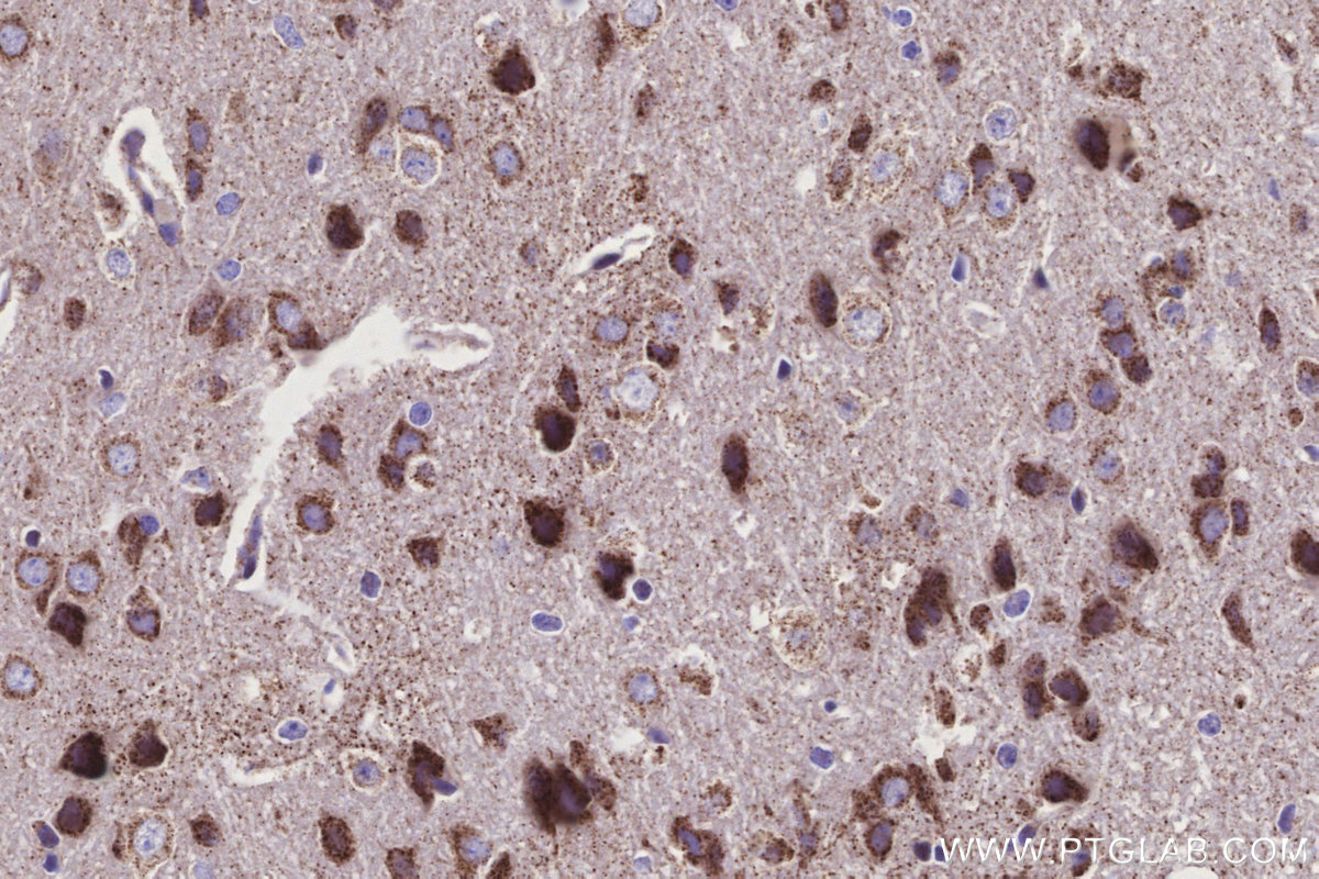 Immunohistochemical analysis of paraffin-embedded mouse brain tissue slide using KHC3149 (NDUFS2 IHC Kit).