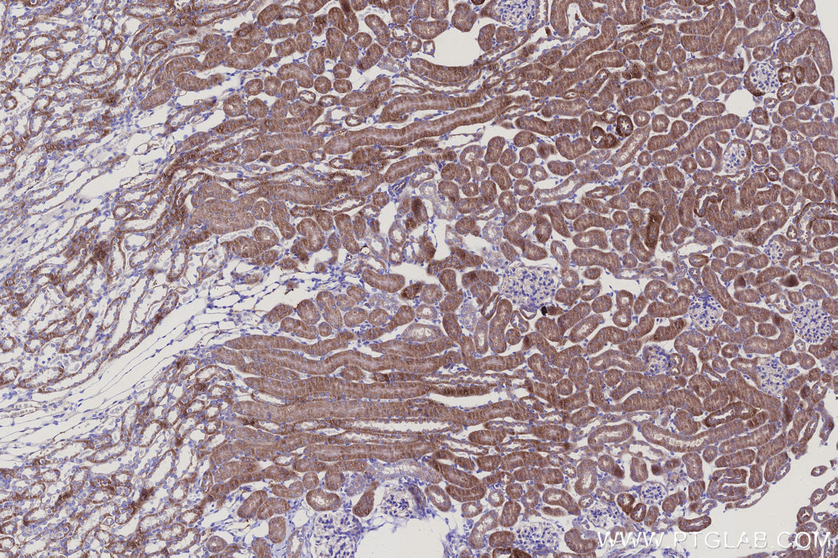 Immunohistochemical analysis of paraffin-embedded mouse kidney tissue slide using KHC3146 (NDUFS5 IHC Kit). Immunohistochemical analysis of paraffin-embedded mouse kidney tissue slide using KHC3146 (NDUFS5 IHC Kit).