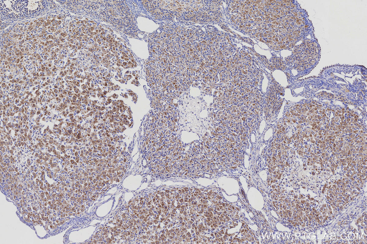 Immunohistochemical analysis of paraffin-embedded rat ovary tissue slide using KHC3146 (NDUFS5 IHC Kit). Immunohistochemical analysis of paraffin-embedded rat ovary tissue slide using KHC3146 (NDUFS5 IHC Kit).