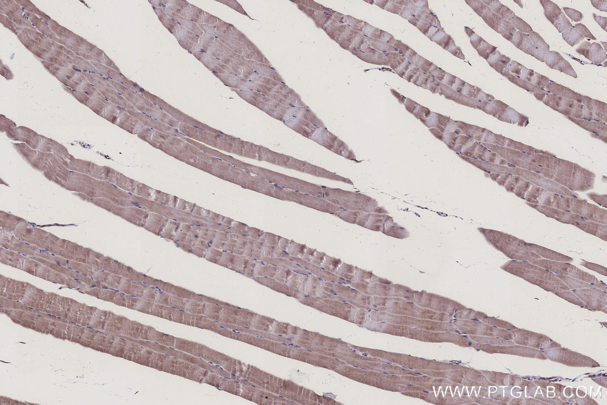 Immunohistochemical analysis of paraffin-embedded mouse skeletal muscle tissue slide using KHC3178 (NDUFS7 IHC Kit). Immunohistochemical analysis of paraffin-embedded mouse skeletal muscle tissue slide using KHC3178 (NDUFS7 IHC Kit).