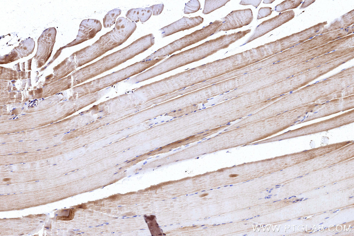 Immunohistochemical analysis of paraffin-embedded rat skeletal muscle tissue slide using KHC3178 (NDUFS7 IHC Kit). Immunohistochemical analysis of paraffin-embedded rat skeletal muscle tissue slide using KHC3178 (NDUFS7 IHC Kit).