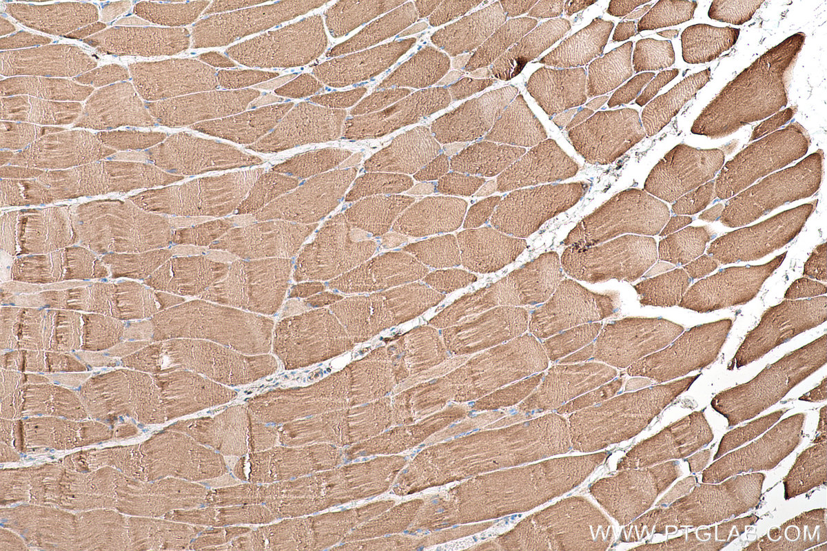 Immunohistochemical analysis of paraffin-embedded rat skeletal muscle tissue slide using KHC0633 (NDUFV1 IHC Kit).