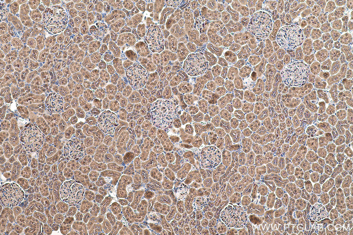 Immunohistochemical analysis of paraffin-embedded rat kidney tissue slide using KHC0633 (NDUFV1 IHC Kit).