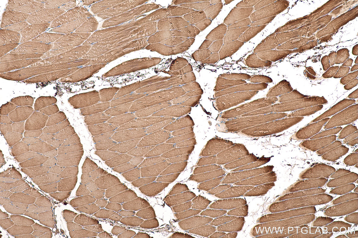 Immunohistochemical analysis of paraffin-embedded mouse skeletal muscle tissue slide using KHC0633 (NDUFV1 IHC Kit).