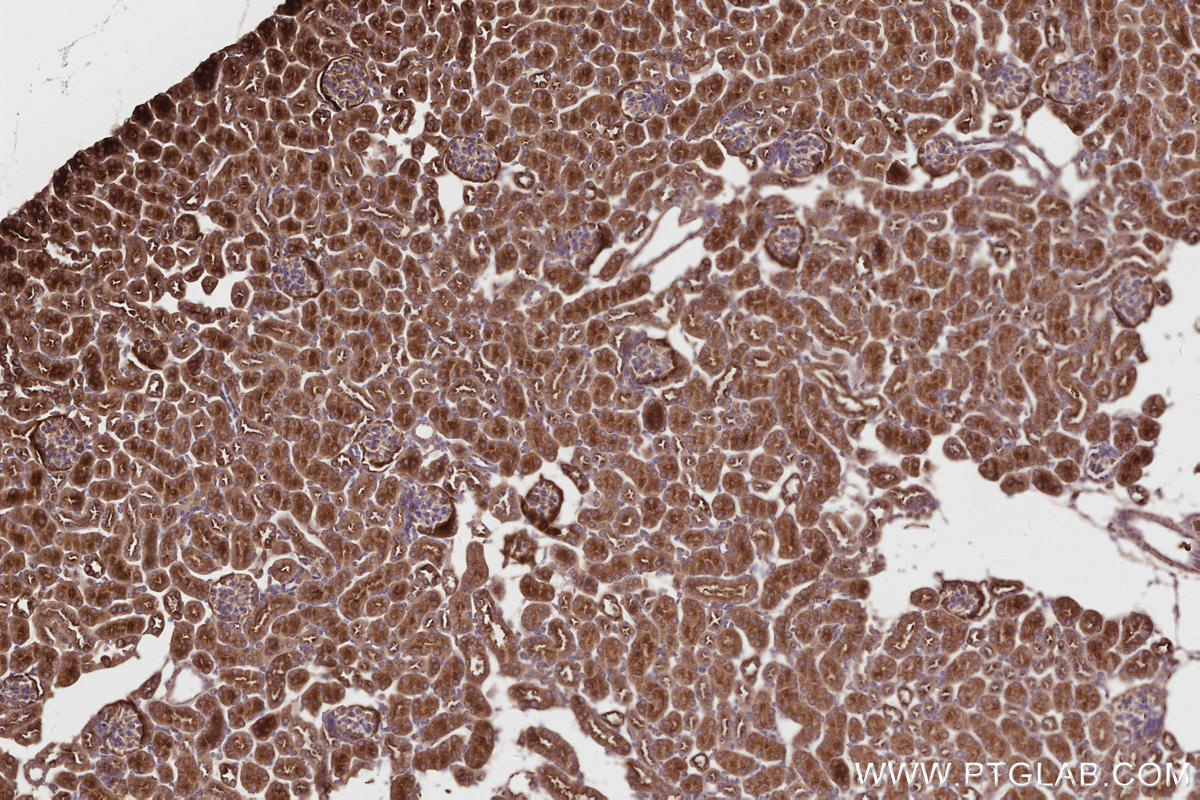 Immunohistochemical analysis of paraffin-embedded mouse kidney tissue slide using KHC2815 (NEDD4L IHC Kit).