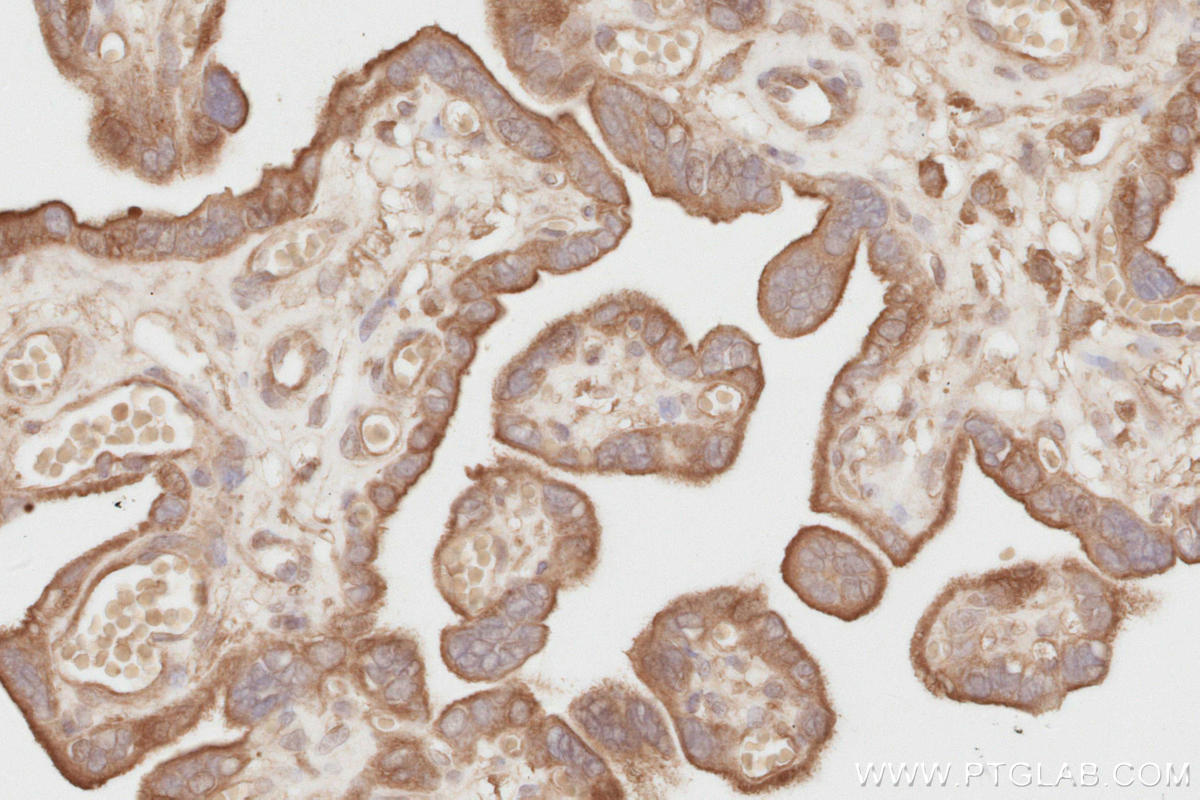 Immunohistochemical analysis of paraffin-embedded human placenta tissue slide using KHC2815 (NEDD4L IHC Kit).