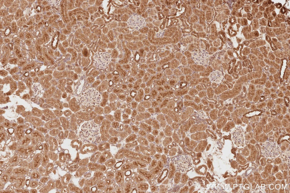 Immunohistochemical analysis of paraffin-embedded rat kidney tissue slide using KHC2815 (NEDD4L IHC Kit).
