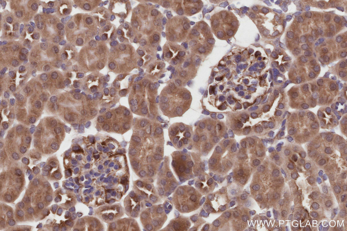 Immunohistochemical analysis of paraffin-embedded mouse kidney tissue slide using KHC2817 (NEK1 IHC Kit).