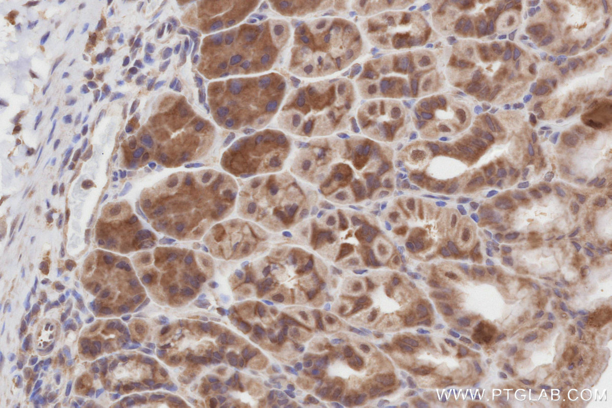 Immunohistochemical analysis of paraffin-embedded mouse stomach tissue slide using KHC2817 (NEK1 IHC Kit).