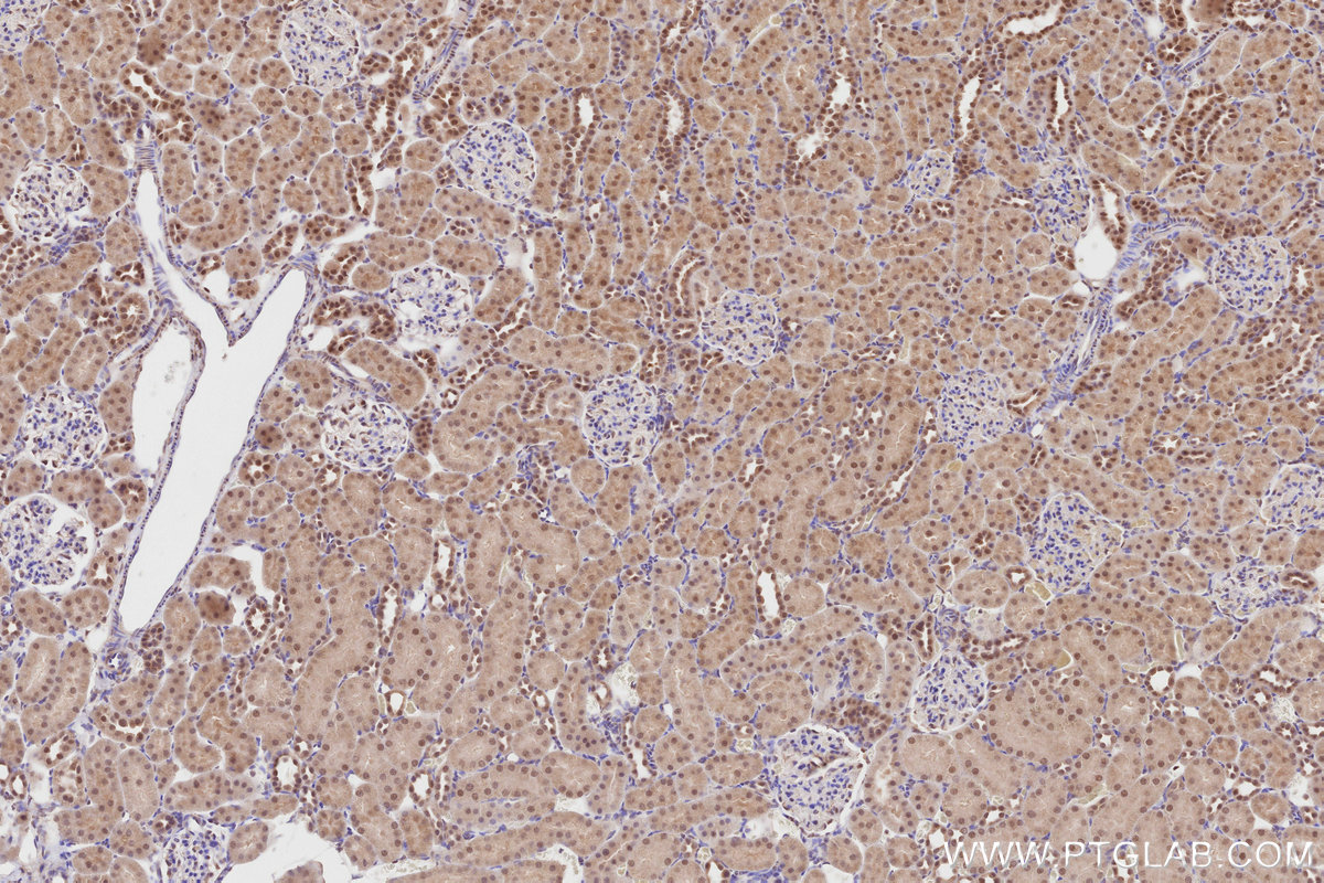 Immunohistochemical analysis of paraffin-embedded rat kidney tissue slide using KHC2817 (NEK1 IHC Kit).