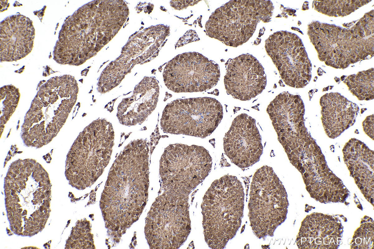 Immunohistochemical analysis of paraffin-embedded mouse testis tissue slide using KHC2308 (NEK4 IHC Kit).