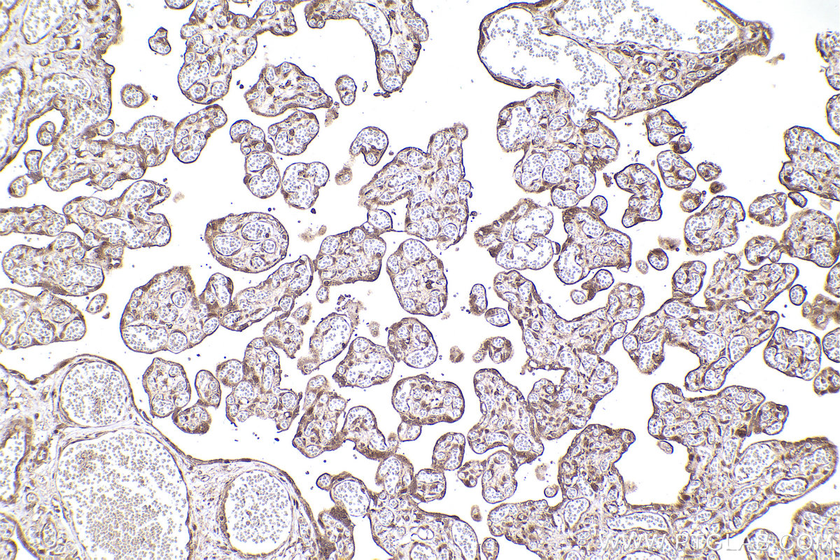 Immunohistochemical analysis of paraffin-embedded human placenta tissue slide using KHC2308 (NEK4 IHC Kit).