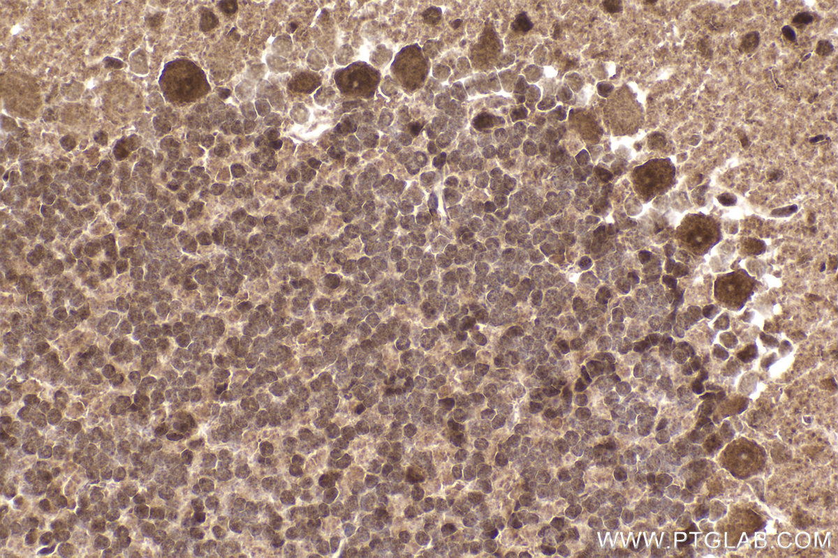 Immunohistochemical analysis of paraffin-embedded mouse cerebellum tissue slide using KHC2308 (NEK4 IHC Kit).