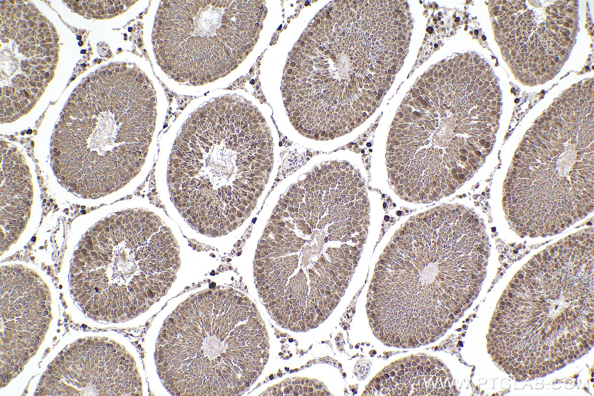 Immunohistochemical analysis of paraffin-embedded rat testis tissue slide using KHC2308 (NEK4 IHC Kit).
