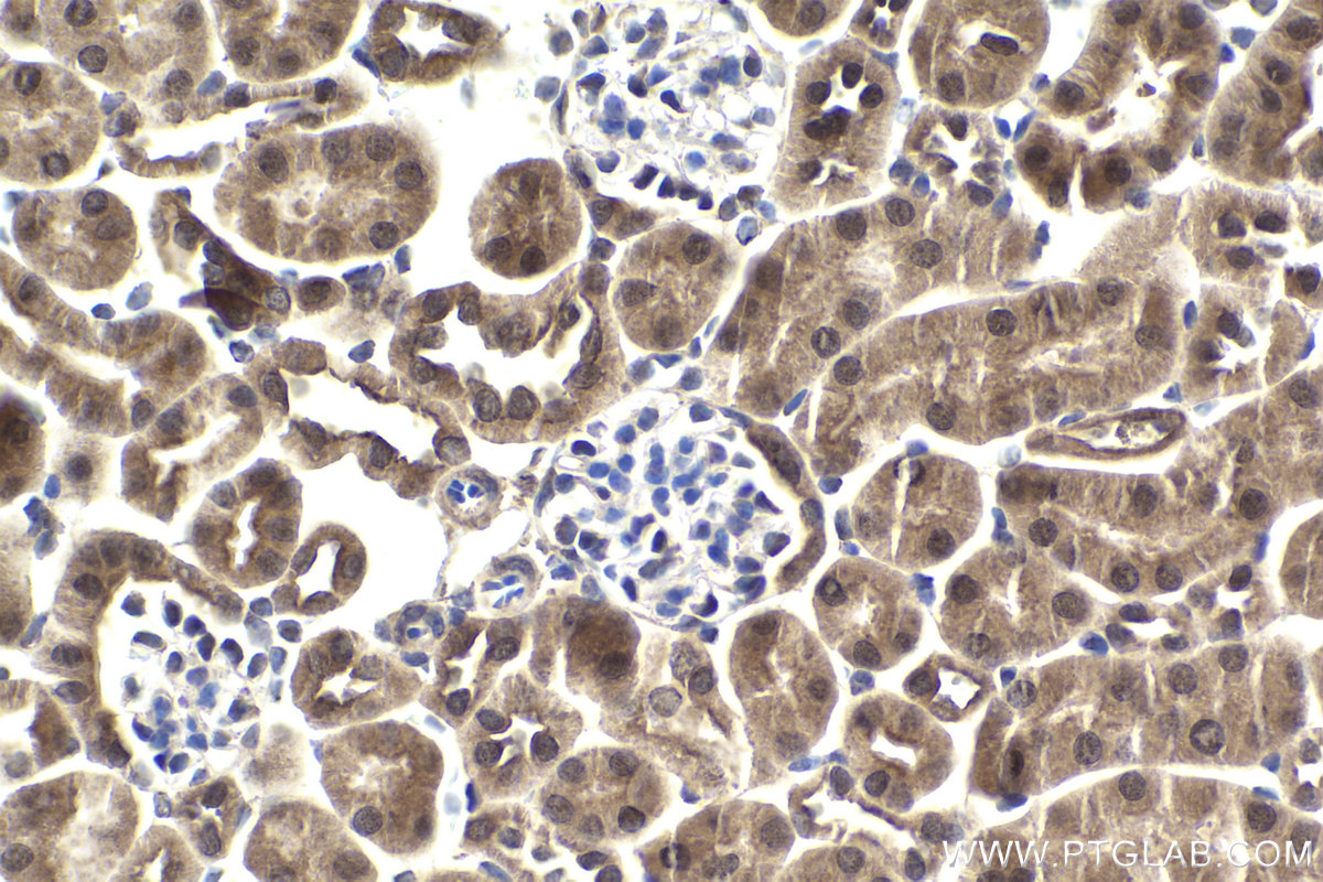 Immunohistochemical analysis of paraffin-embedded mouse kidney tissue slide using KHC1945 (NEK6 IHC Kit).