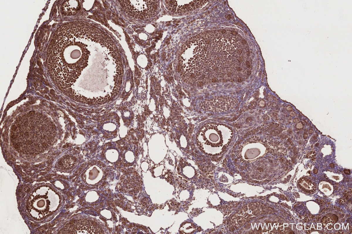 Immunohistochemical analysis of paraffin-embedded mouse ovary tissue slide using KHC2720 (NEK7 IHC Kit).