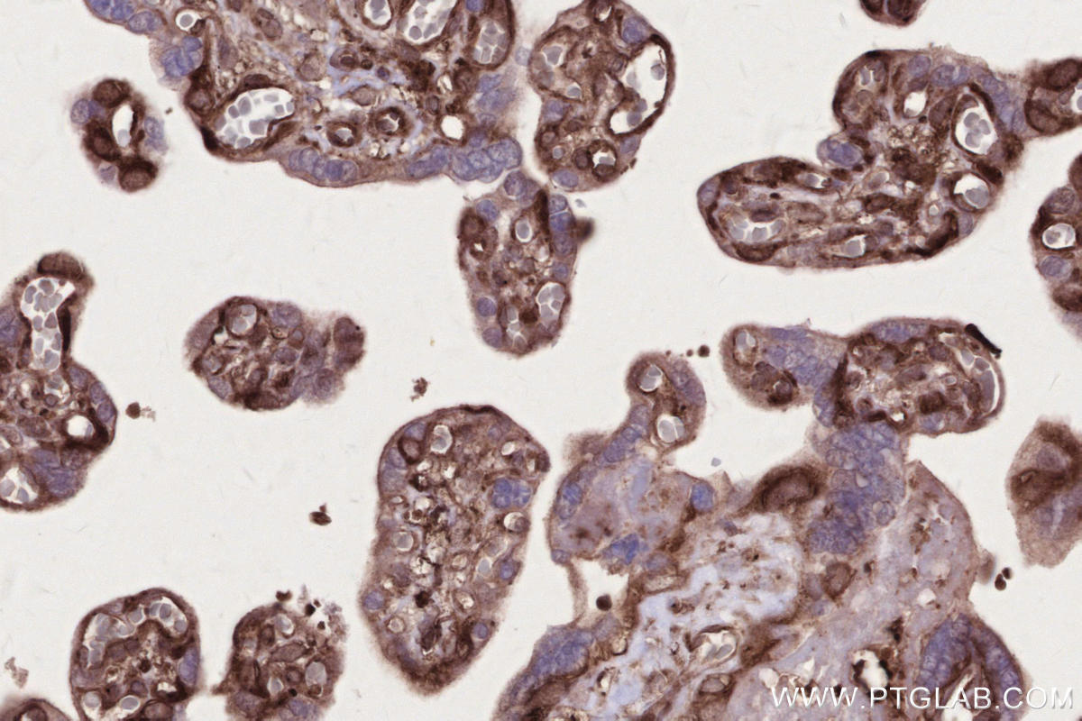 Immunohistochemical analysis of paraffin-embedded human placenta tissue slide using KHC2716 (NEK9 IHC Kit).