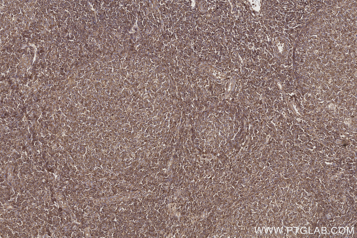 Immunohistochemical analysis of paraffin-embedded human tonsillitis tissue slide using KHC2716 (NEK9 IHC Kit).