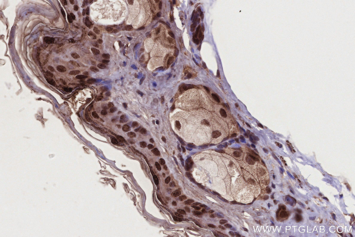 Immunohistochemical analysis of paraffin-embedded mouse skin tissue slide using KHC2716 (NEK9 IHC Kit).