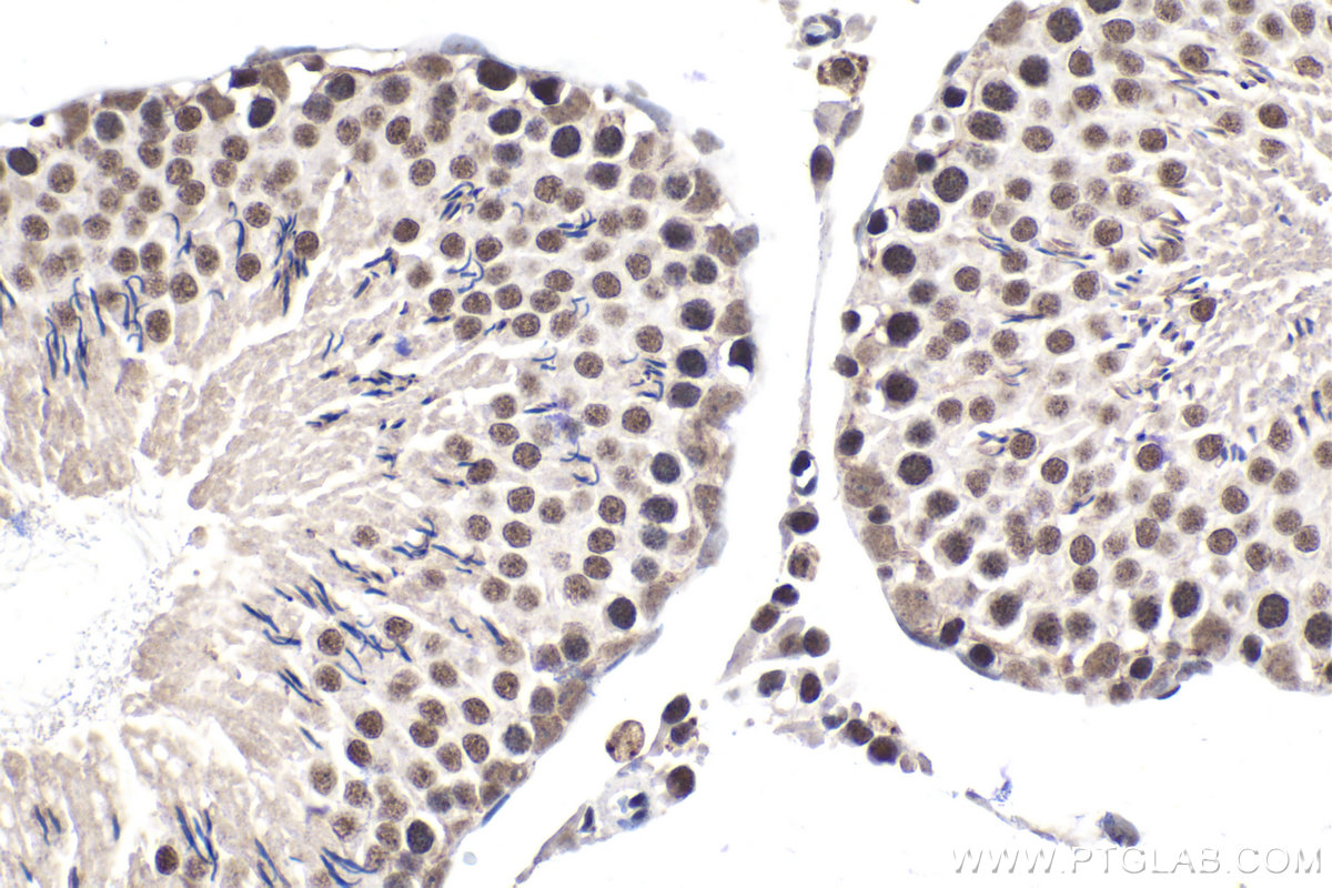Immunohistochemical analysis of paraffin-embedded rat testis tissue slide using KHC1542 (NELFE IHC Kit).