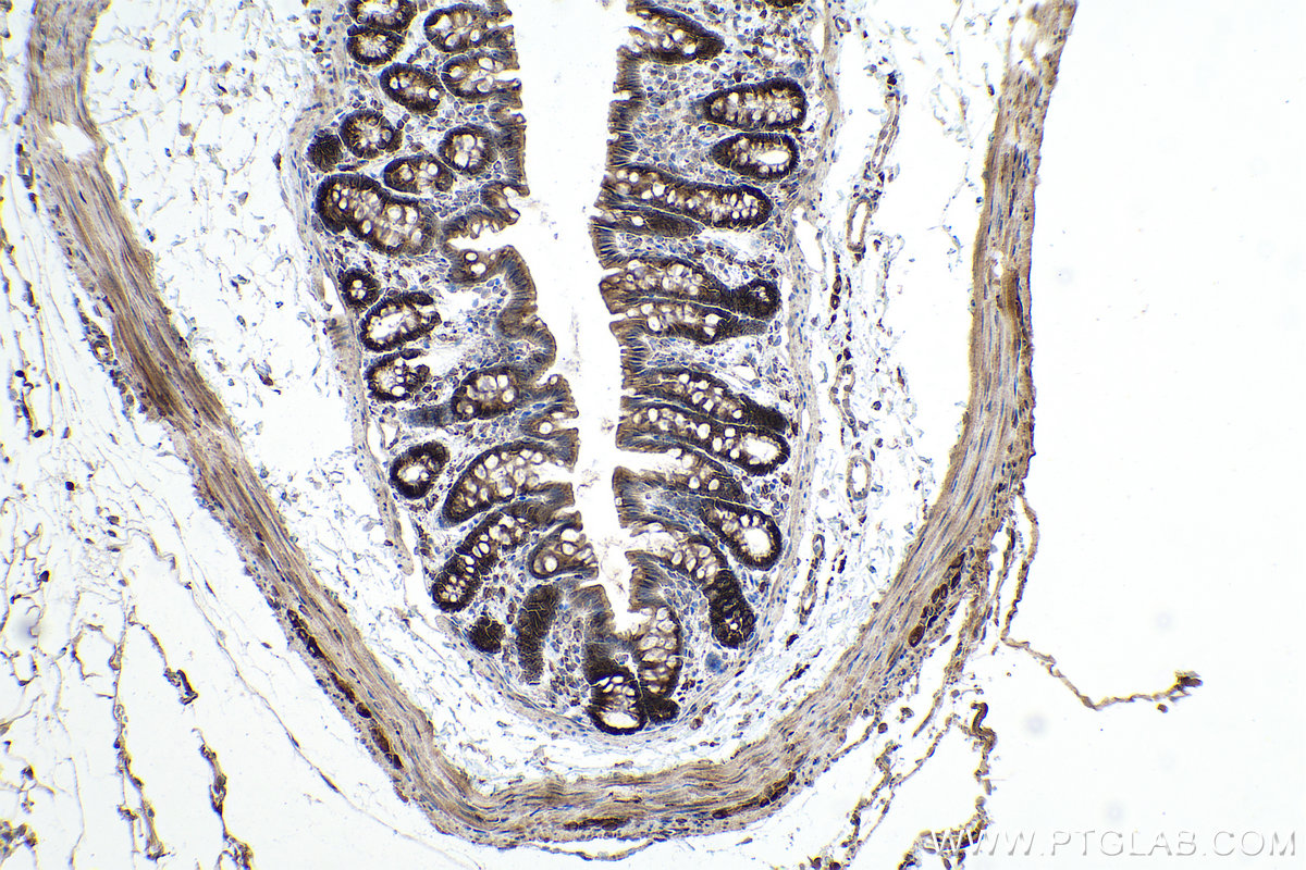 Immunohistochemical analysis of paraffin-embedded rat colon tissue slide using KHC0897 (NENF IHC Kit).