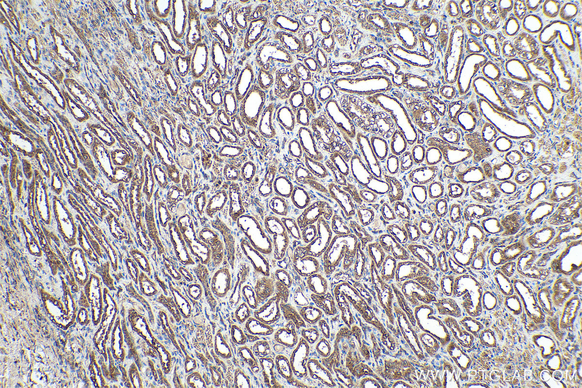 Immunohistochemical analysis of paraffin-embedded human kidney tissue slide using KHC0897 (NENF IHC Kit).