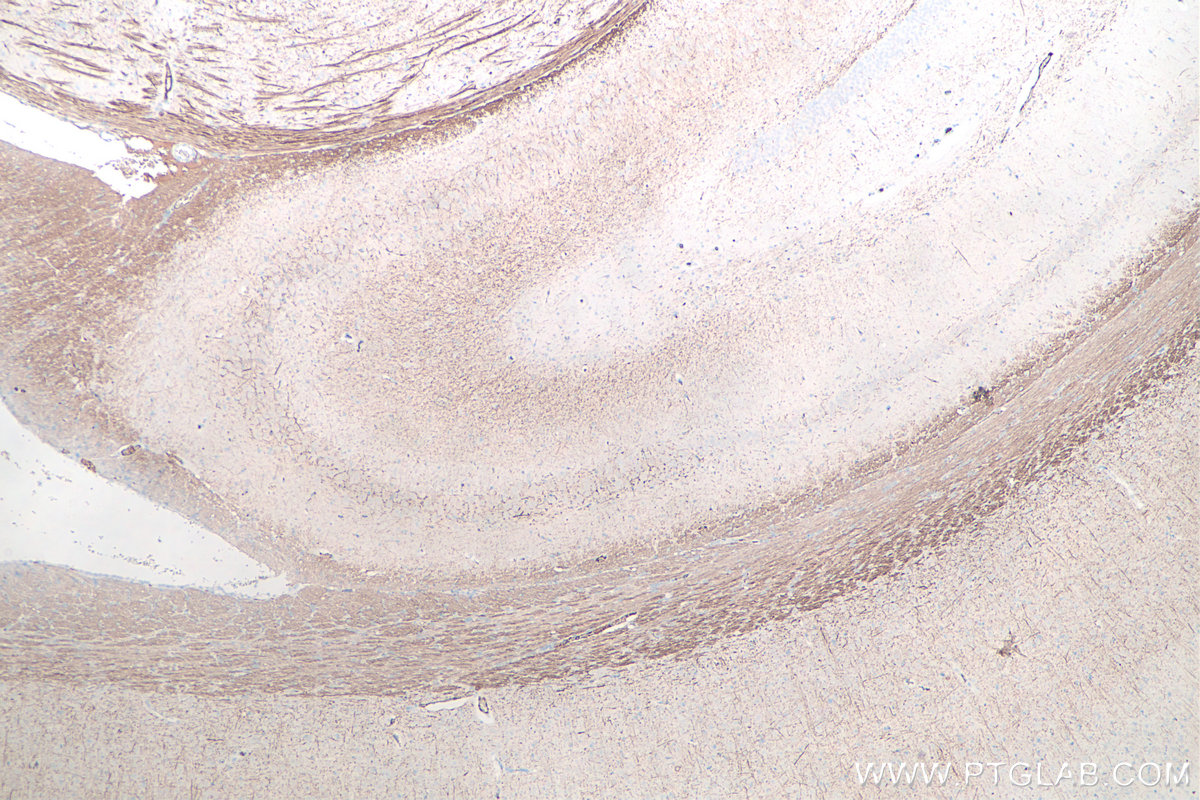 Immunohistochemical analysis of paraffin-embedded rat brain tissue slide using KHC0046 (NF-H/NF200 IHC Kit).