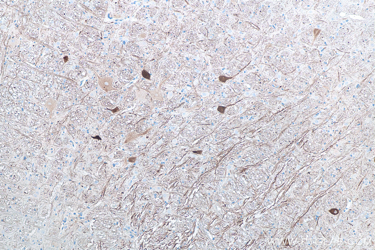 Immunohistochemical analysis of paraffin-embedded rat cerebellum tissue slide using KHC0046 (NF-H/NF200 IHC Kit).