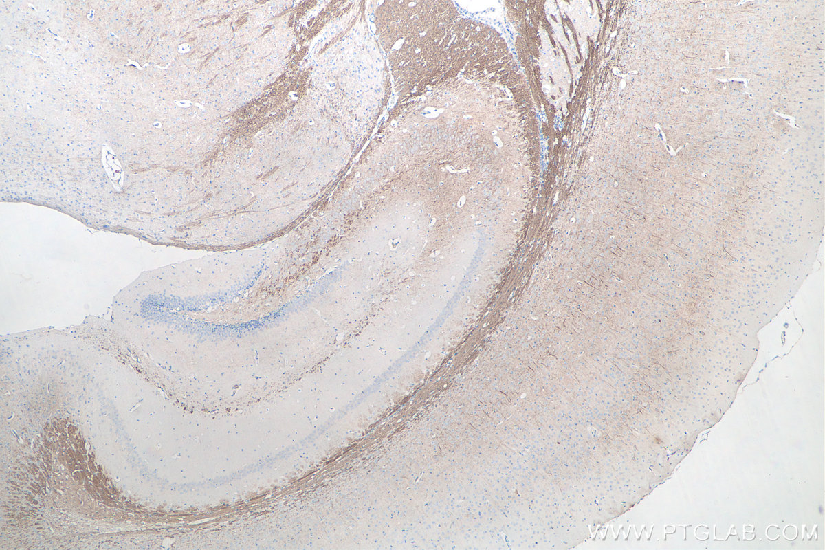 Immunohistochemical analysis of paraffin-embedded mouse brain tissue slide using KHC0044 (NF-L IHC Kit).