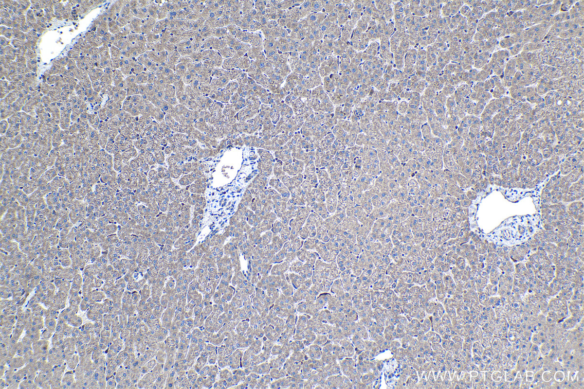 Immunohistochemical analysis of paraffin-embedded human liver tissue slide using KHC1057 (NF1 IHC Kit).