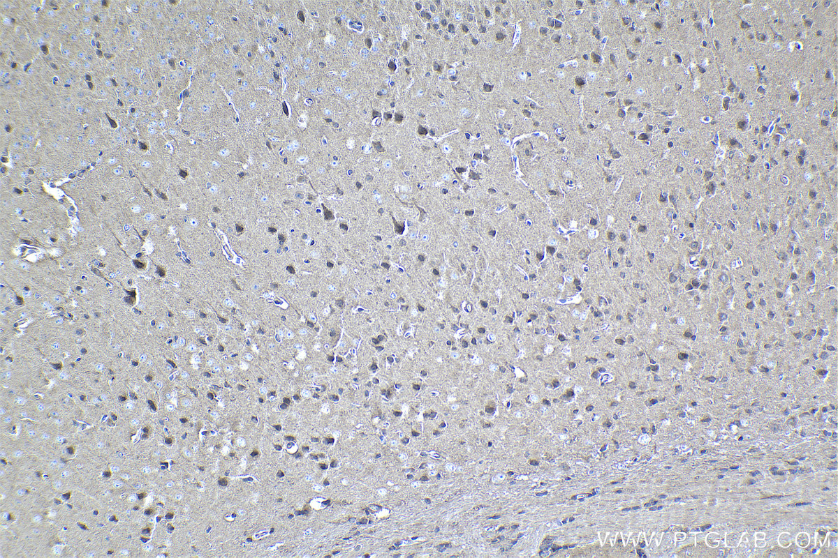 Immunohistochemical analysis of paraffin-embedded mouse brain tissue slide using KHC1057 (NF1 IHC Kit).