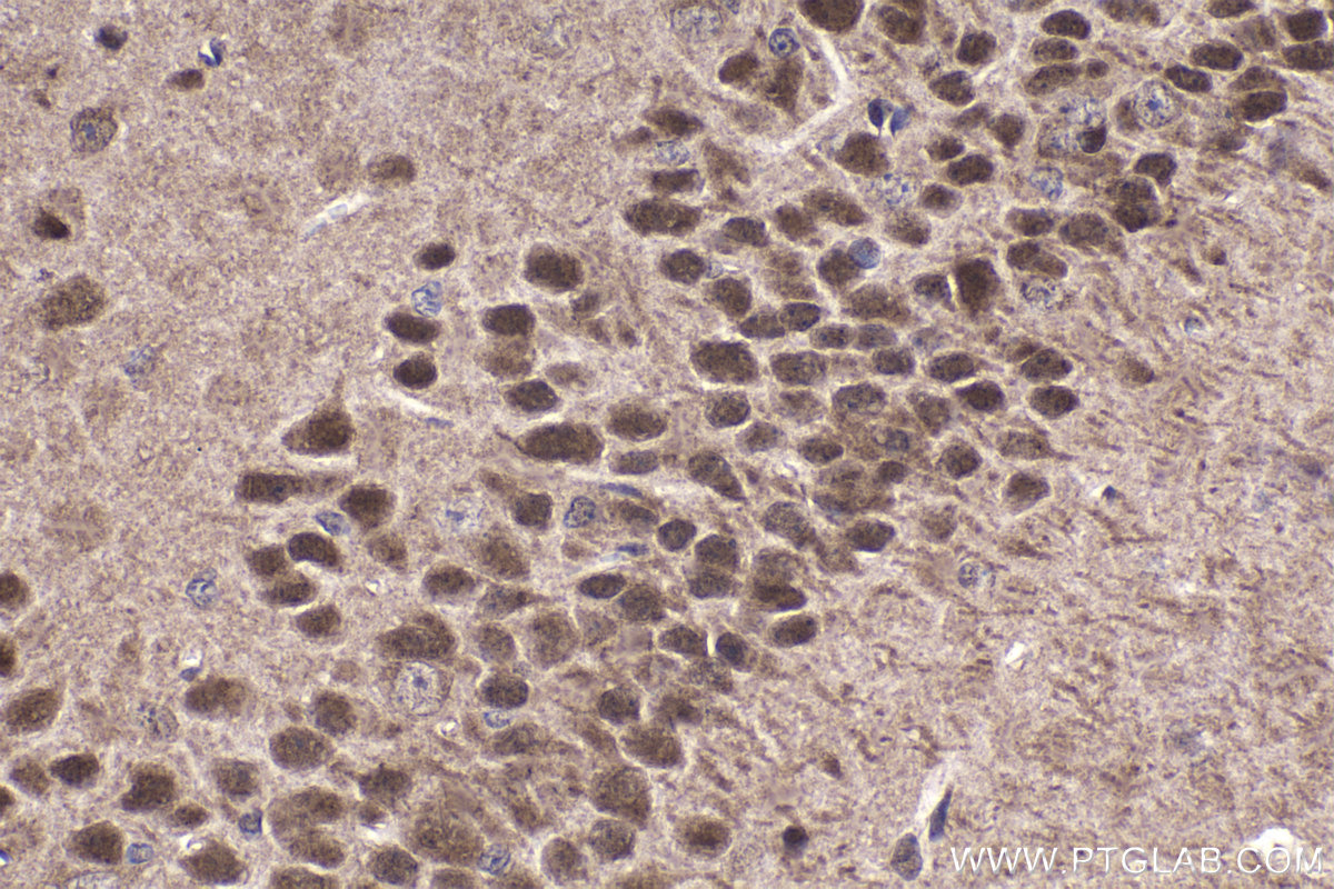 Immunohistochemical analysis of paraffin-embedded mouse brain tissue slide using KHC1488 (NFAT5 IHC Kit).