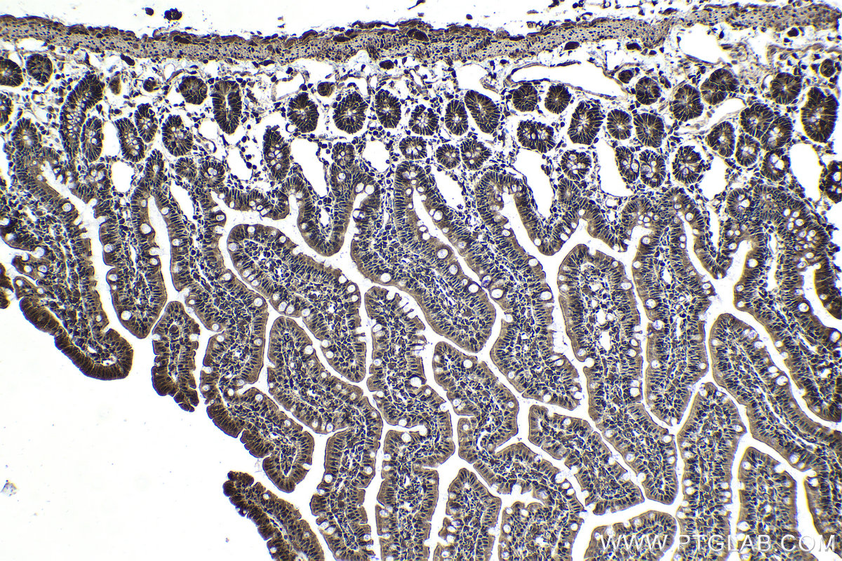 Immunohistochemical analysis of paraffin-embedded rat small intestine tissue slide using KHC1712 (NFATC2 IHC Kit).