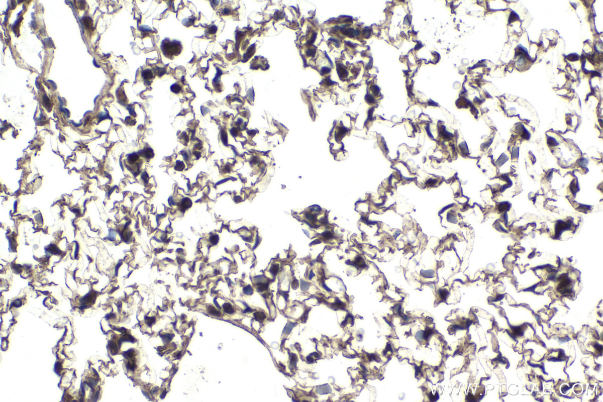 Immunohistochemical analysis of paraffin-embedded rat lung tissue slide using KHC1712 (NFATC2 IHC Kit).