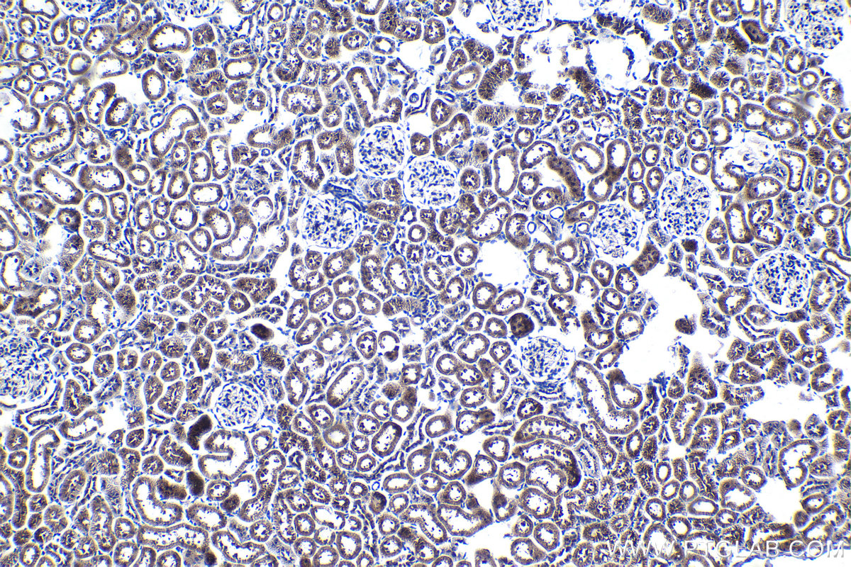 Immunohistochemical analysis of paraffin-embedded rat kidney tissue slide using KHC1065 (NFE2L2/NRF2 IHC Kit).