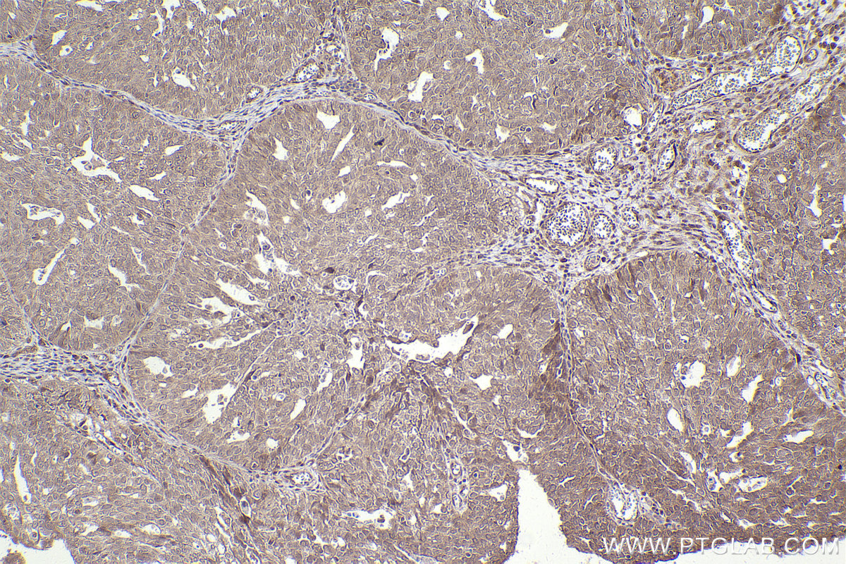 IHCeasy NFE2L2/NRF2 Ready-To-Use IHC Kit KHC2502 | Proteintech | 武汉三鹰生物 ...