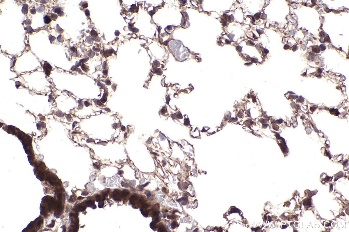 Immunohistochemical analysis of paraffin-embedded mouse lung tissue slide using KHC2502 (NFE2L2/NRF2 IHC Kit).
