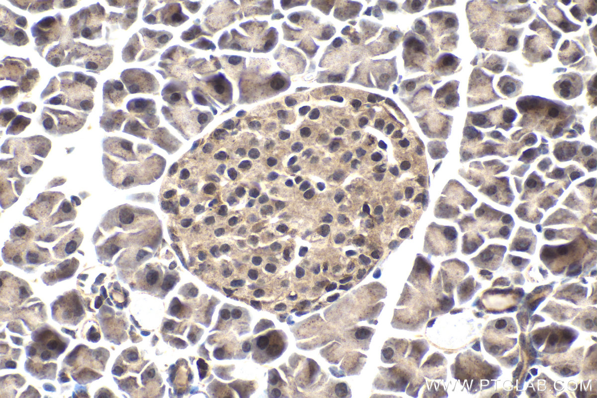 Immunohistochemical analysis of paraffin-embedded mouse pancreas tissue slide using KHC1659 (NFKB2 IHC Kit).