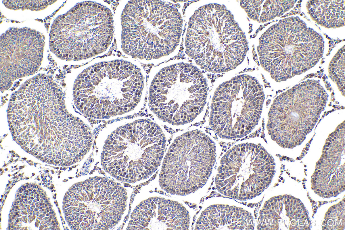 Immunohistochemical analysis of paraffin-embedded rat testis tissue slide using KHC1659 (NFKB2 IHC Kit).
