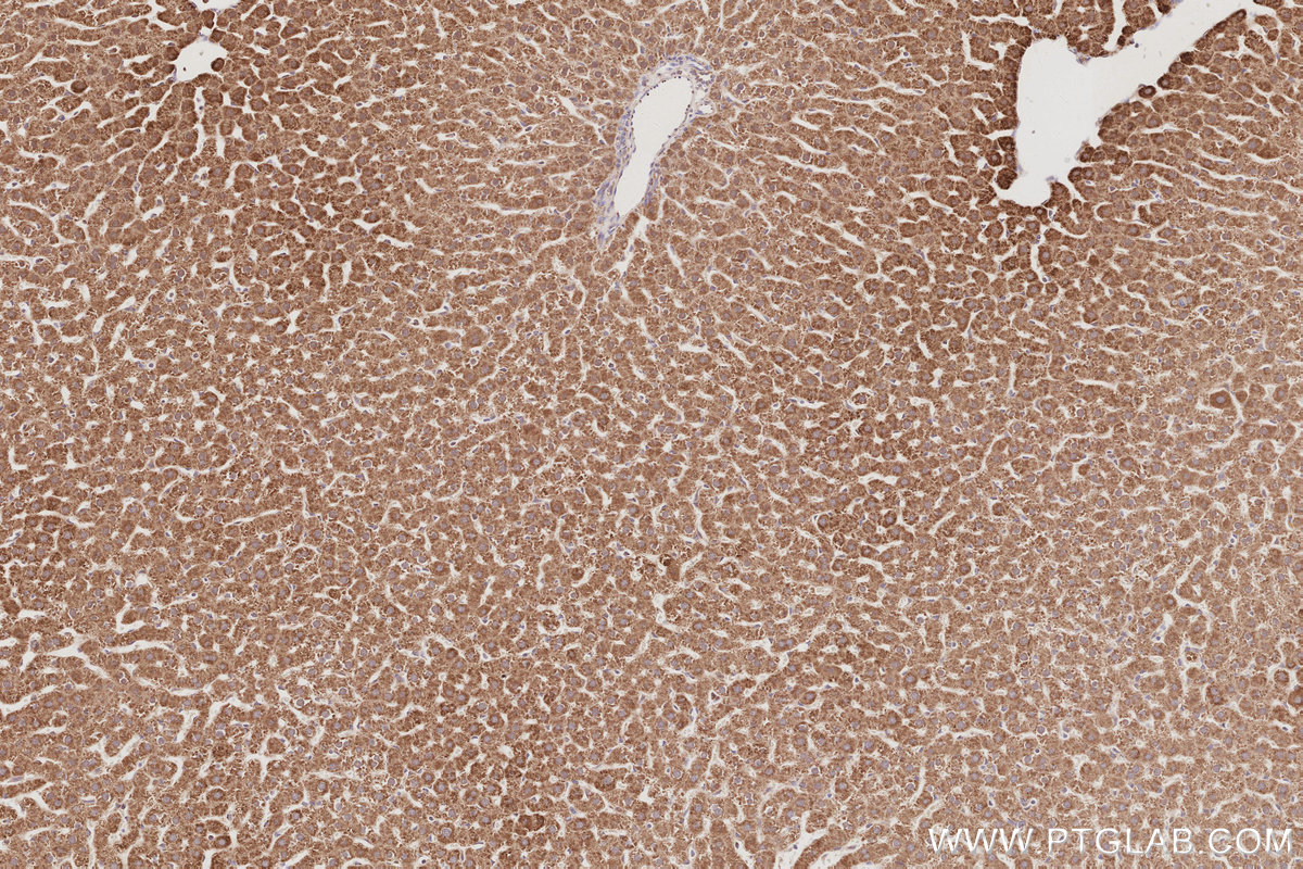 Immunohistochemical analysis of paraffin-embedded rat liver tissue slide using KHC3085 (NFS1 IHC Kit). Immunohistochemical analysis of paraffin-embedded rat liver tissue slide using KHC3085 (NFS1 IHC Kit).