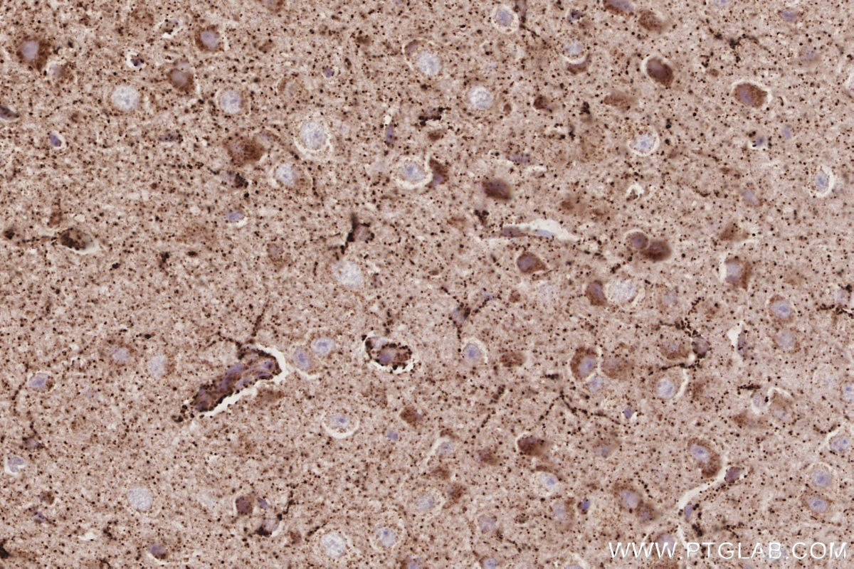 Immunohistochemical analysis of paraffin-embedded mouse brain tissue slide using KHC3085 (NFS1 IHC Kit). Immunohistochemical analysis of paraffin-embedded mouse brain tissue slide using KHC3085 (NFS1 IHC Kit).