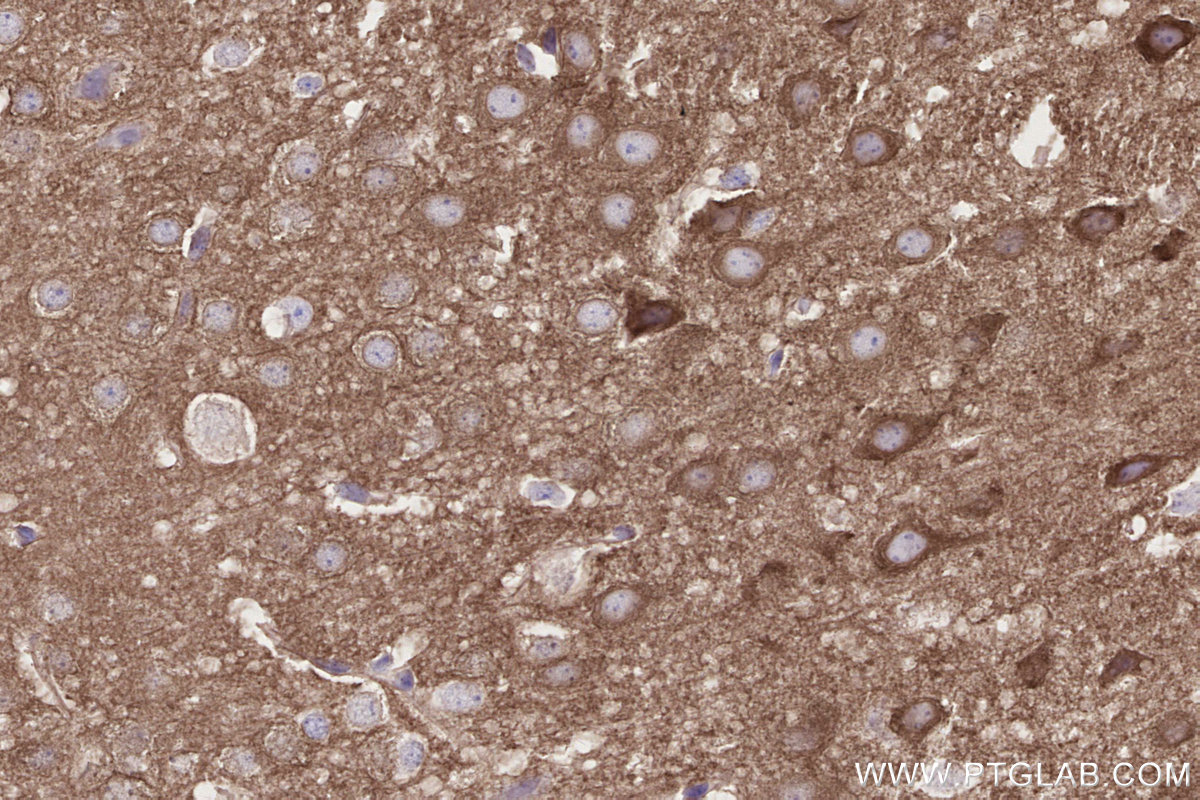 Immunohistochemical analysis of paraffin-embedded mouse brain tissue slide using KHC2678 (NGEF IHC Kit).