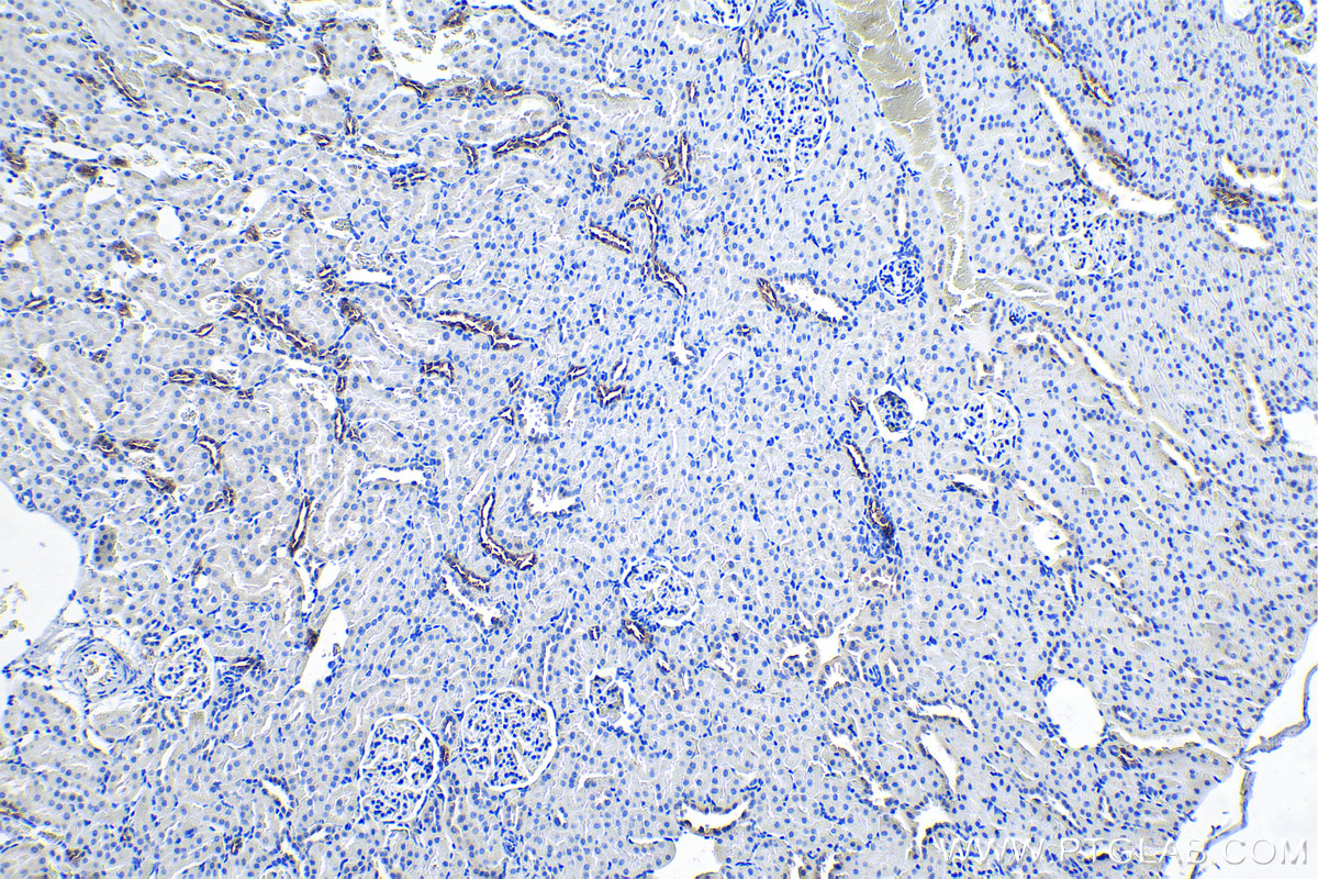 Immunohistochemical analysis of paraffin-embedded rat kidney tissue slide using KHC0189 (NKCC2 IHC Kit).