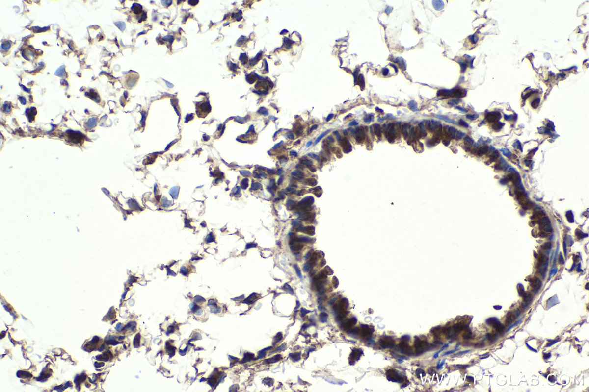 Immunohistochemical analysis of paraffin-embedded rat lung tissue slide using KHC1913 (NLRP1 IHC Kit).