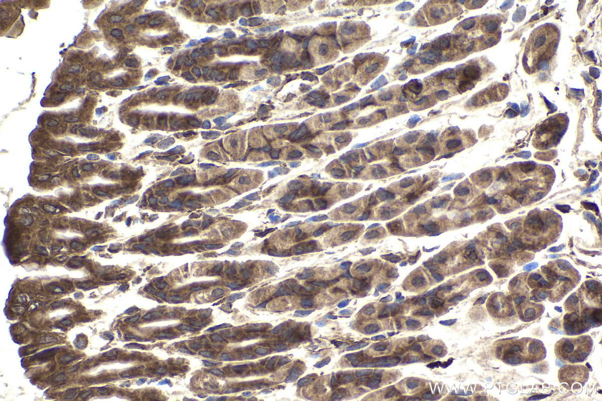 Immunohistochemical analysis of paraffin-embedded mouse stomach tissue slide using KHC1913 (NLRP1 IHC Kit).