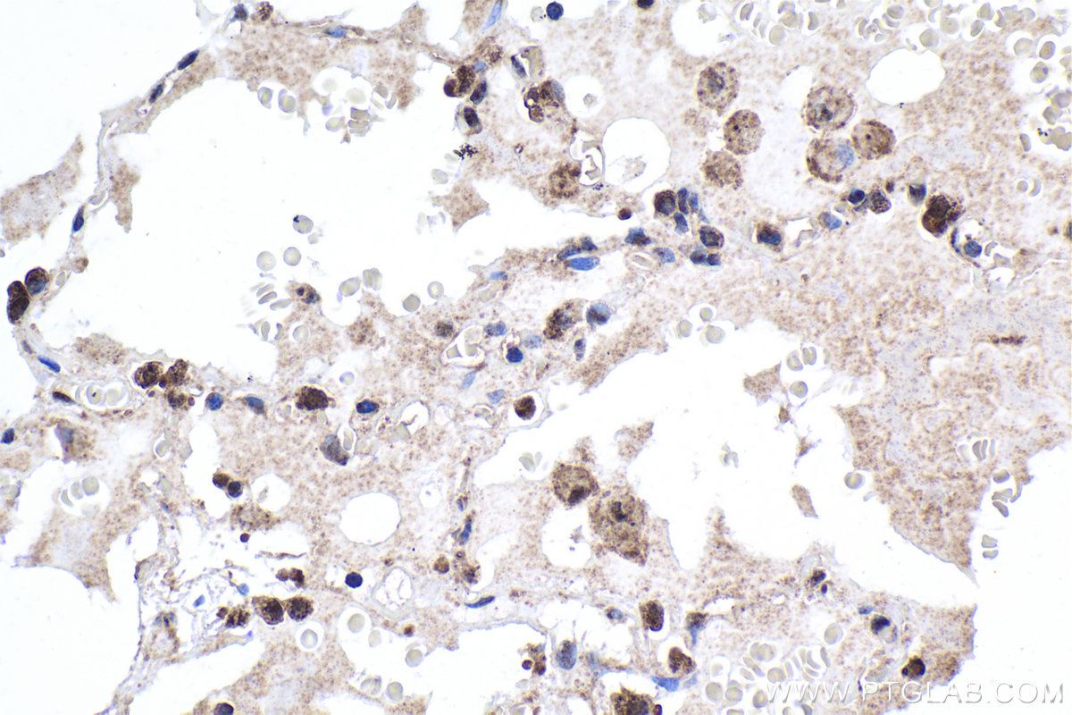 Immunohistochemical analysis of paraffin-embedded human lung tissue slide using KHC1881 (NLRP3 IHC Kit).