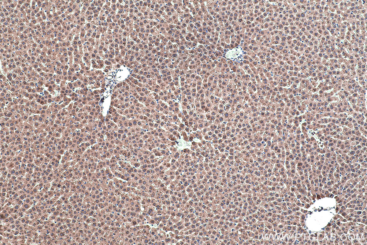 Immunohistochemical analysis of paraffin-embedded rat liver tissue slide using KHC0442 (NME1 IHC Kit).